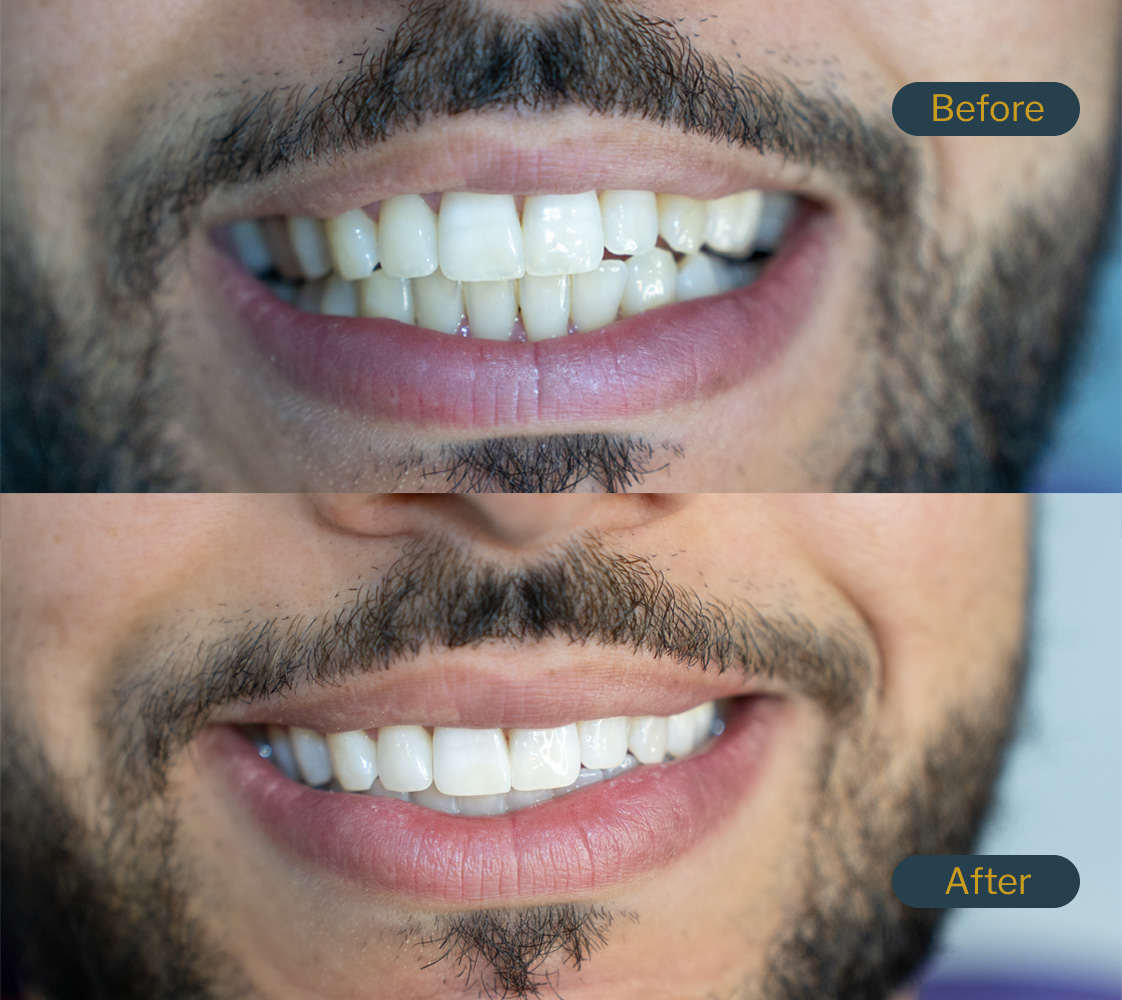 bourgeois dental clinic