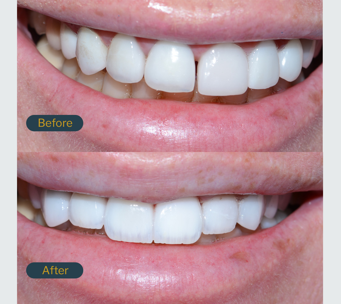 bourgeois dental clinic