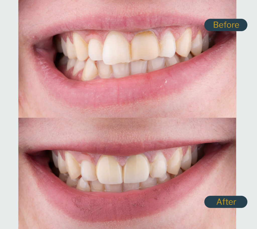 bourgeois dental clinic